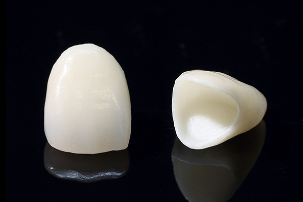 白い歯の治療