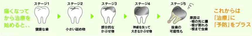 将来の安心~患者さまの歯を長持ちさせることを第一に考えます~